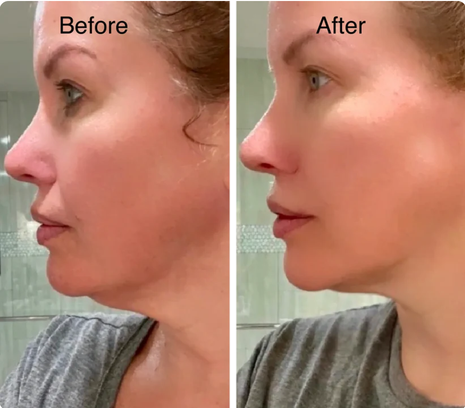 Lymphatic Contour Face Brush